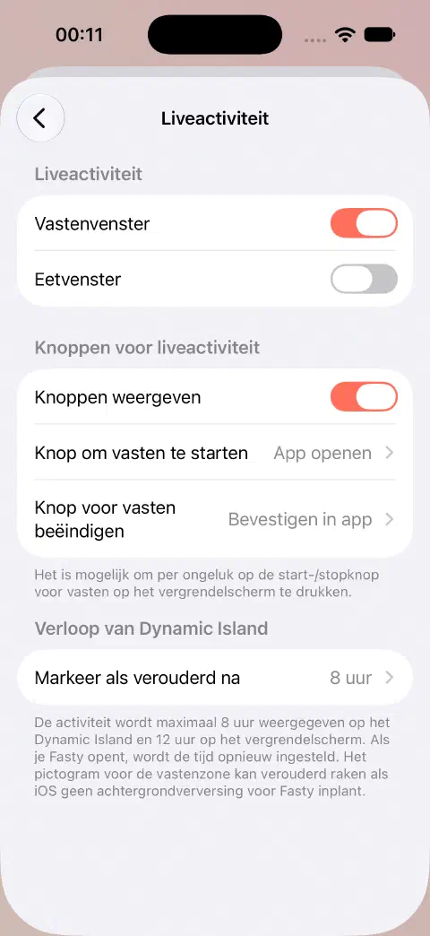 Instellingen met aparte vasten- en eetschakelaars, knopgedrag en vervalinstellingen voor het Dynamic Island.